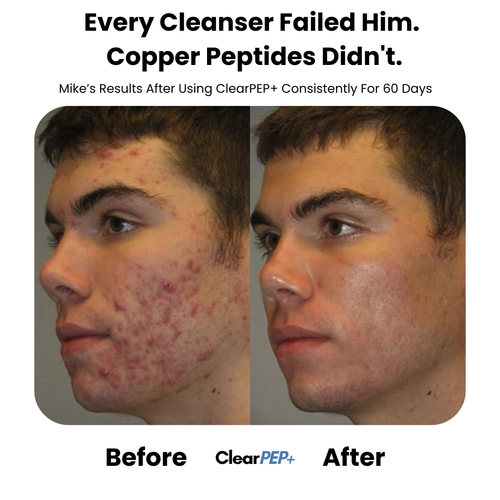 ClearPep+™ Copper Peptide Repair Balm